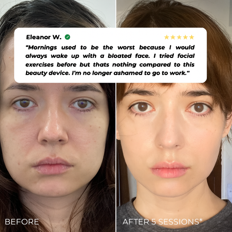 Before and After Result