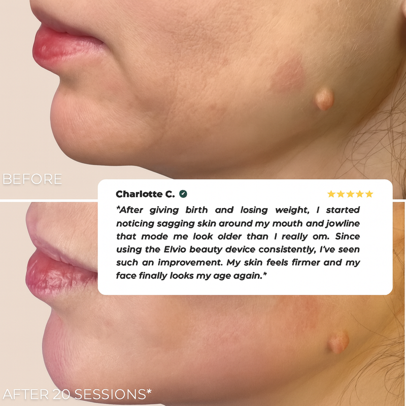 Before and After Result