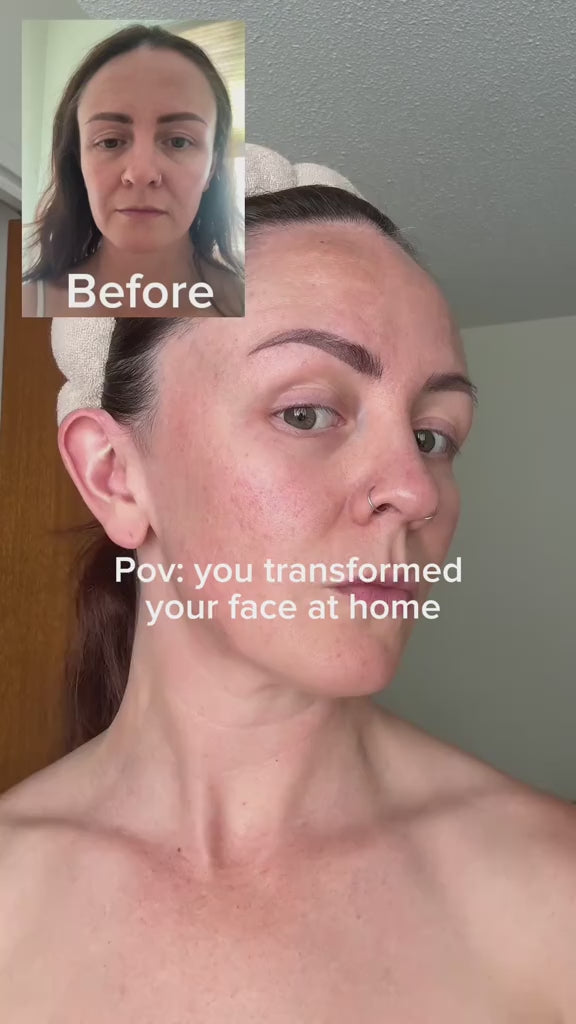 Glovance™ EMS Lift N' Glow Kit video